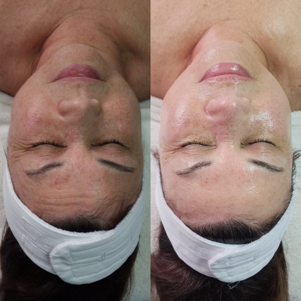 Tulips Skin Clinic gallery 1
