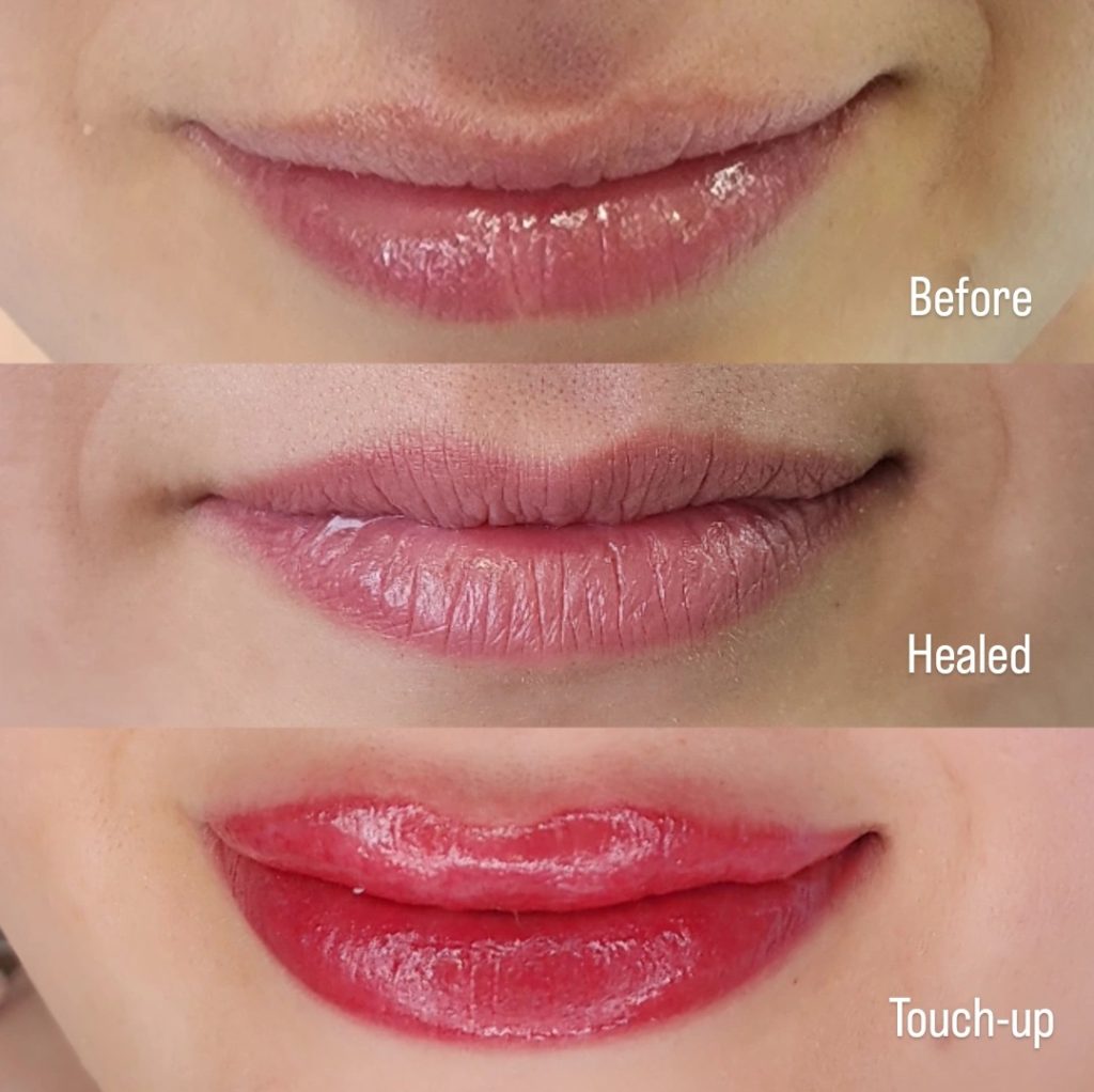 Tulips Skin Clinic gallery 2