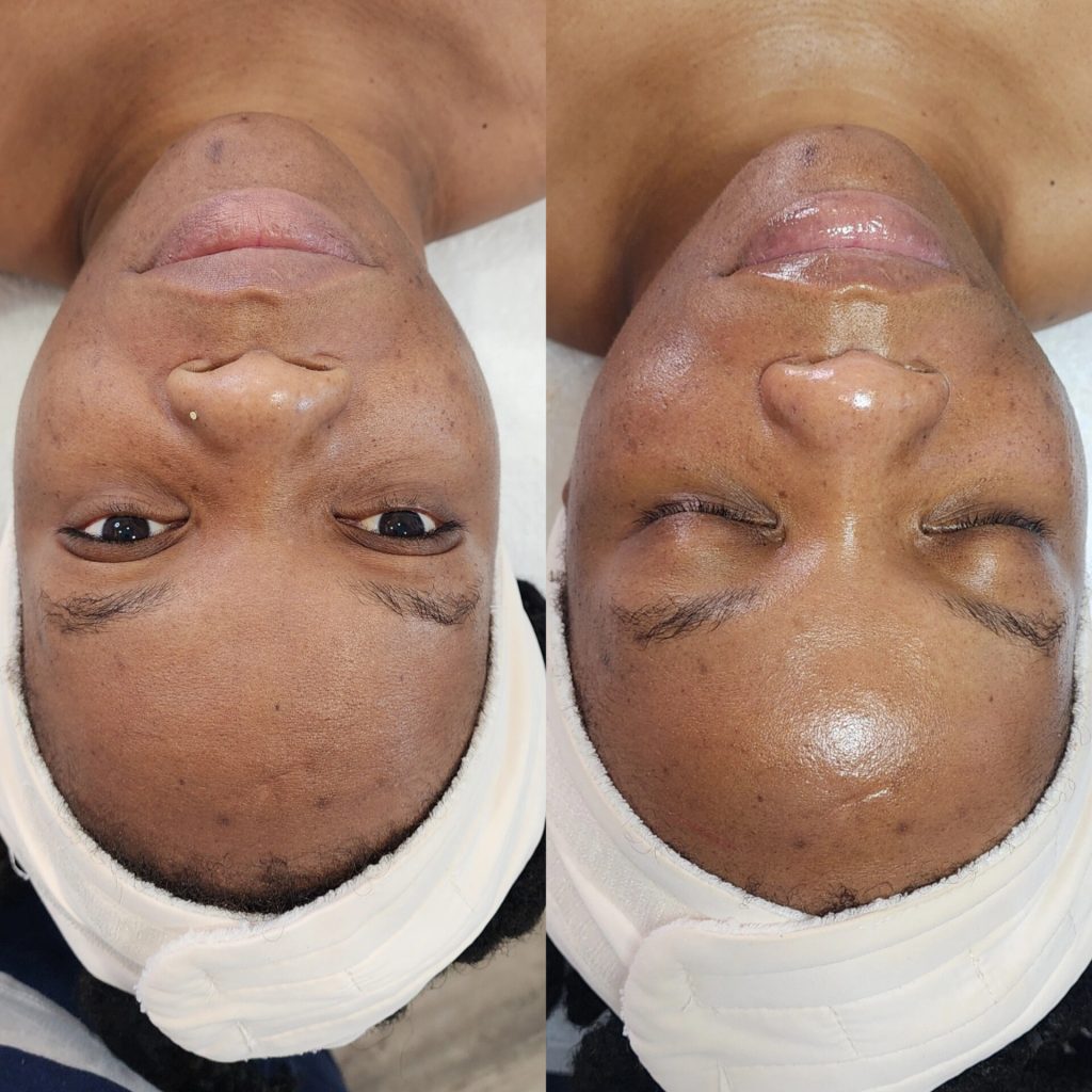 Tulips Skin Clinic gallery 3