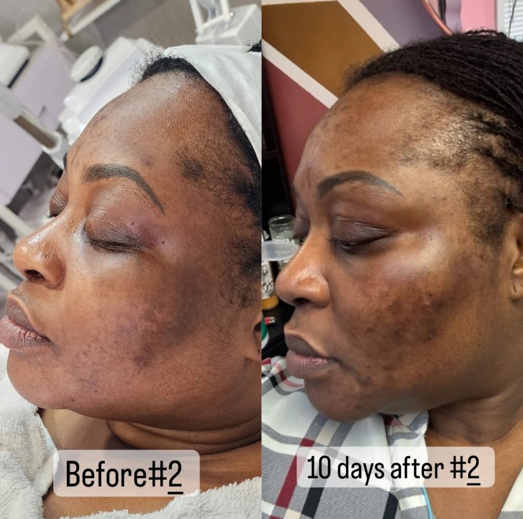 Tulips Skin Clinic gallery 6