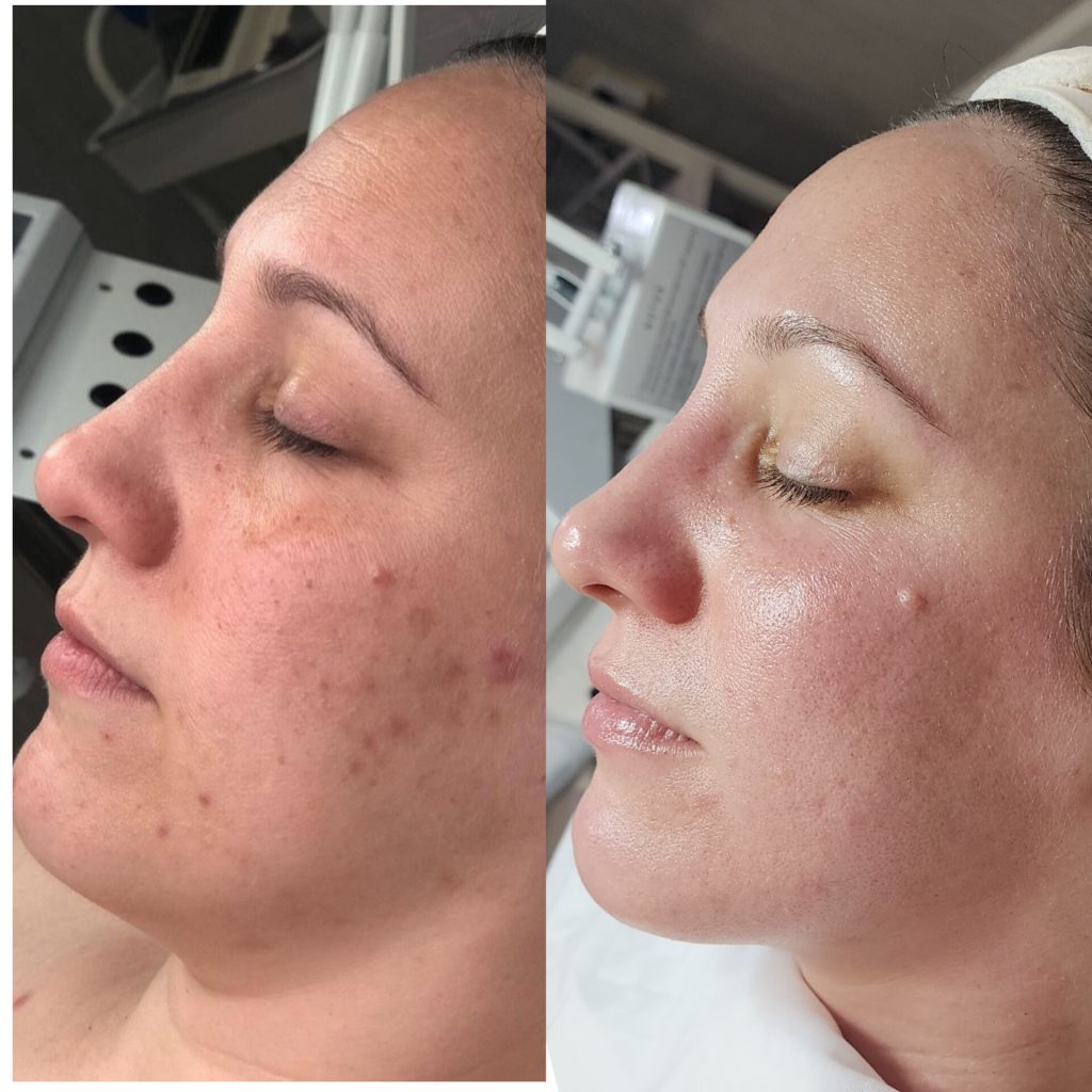 Tulips Skin Clinic gallery 7