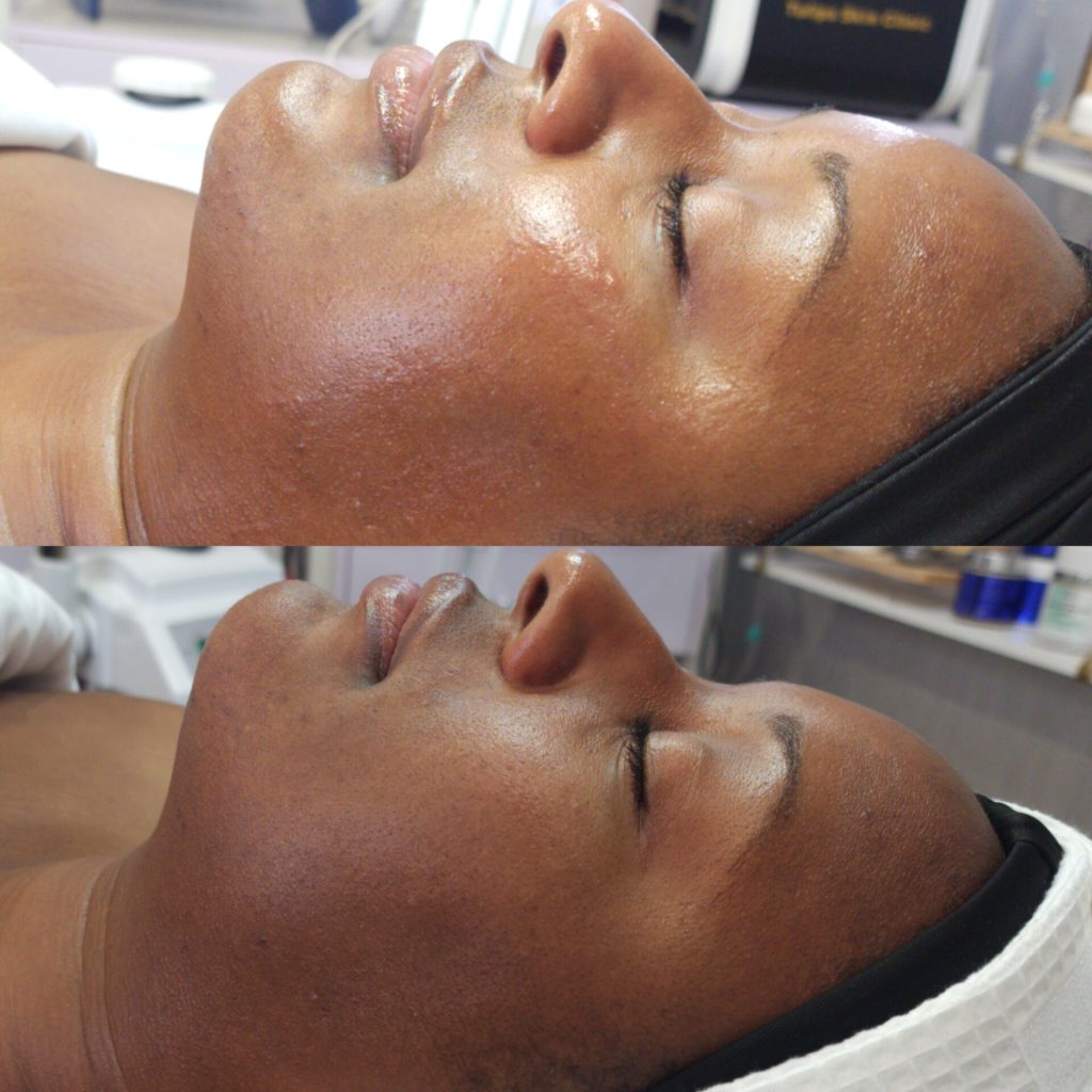 Tulips Skin Clinic gallery 8
