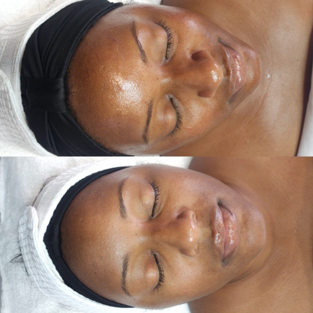 Tulips Skin Clinic gallery 9