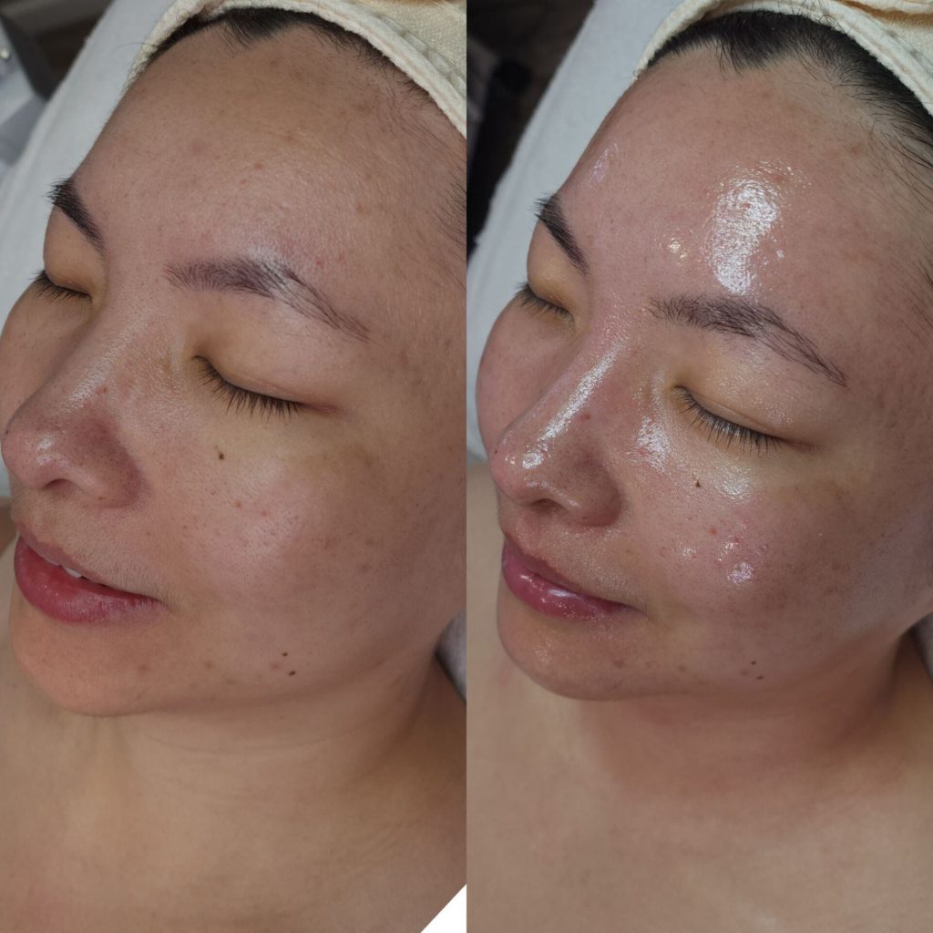 Tulips Skin Clinic gallery 10