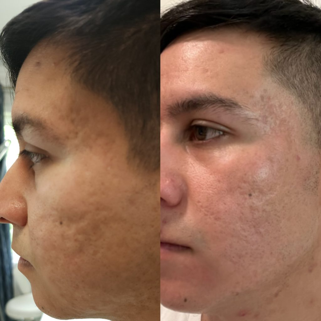 Tulips Skin Clinic gallery 11