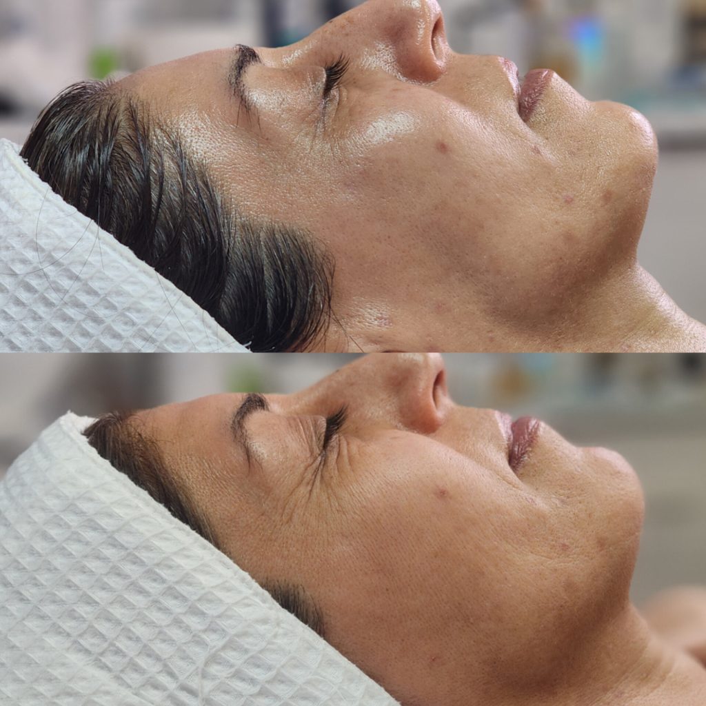 Tulips Skin Clinic gallery 12